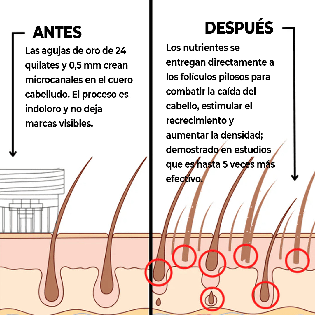 MascoLuciel™ Cuidado Capilar Temprano