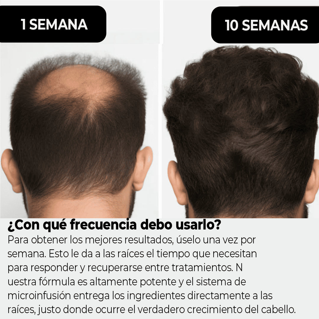 MascoLuciel™ Cuidado Capilar Temprano