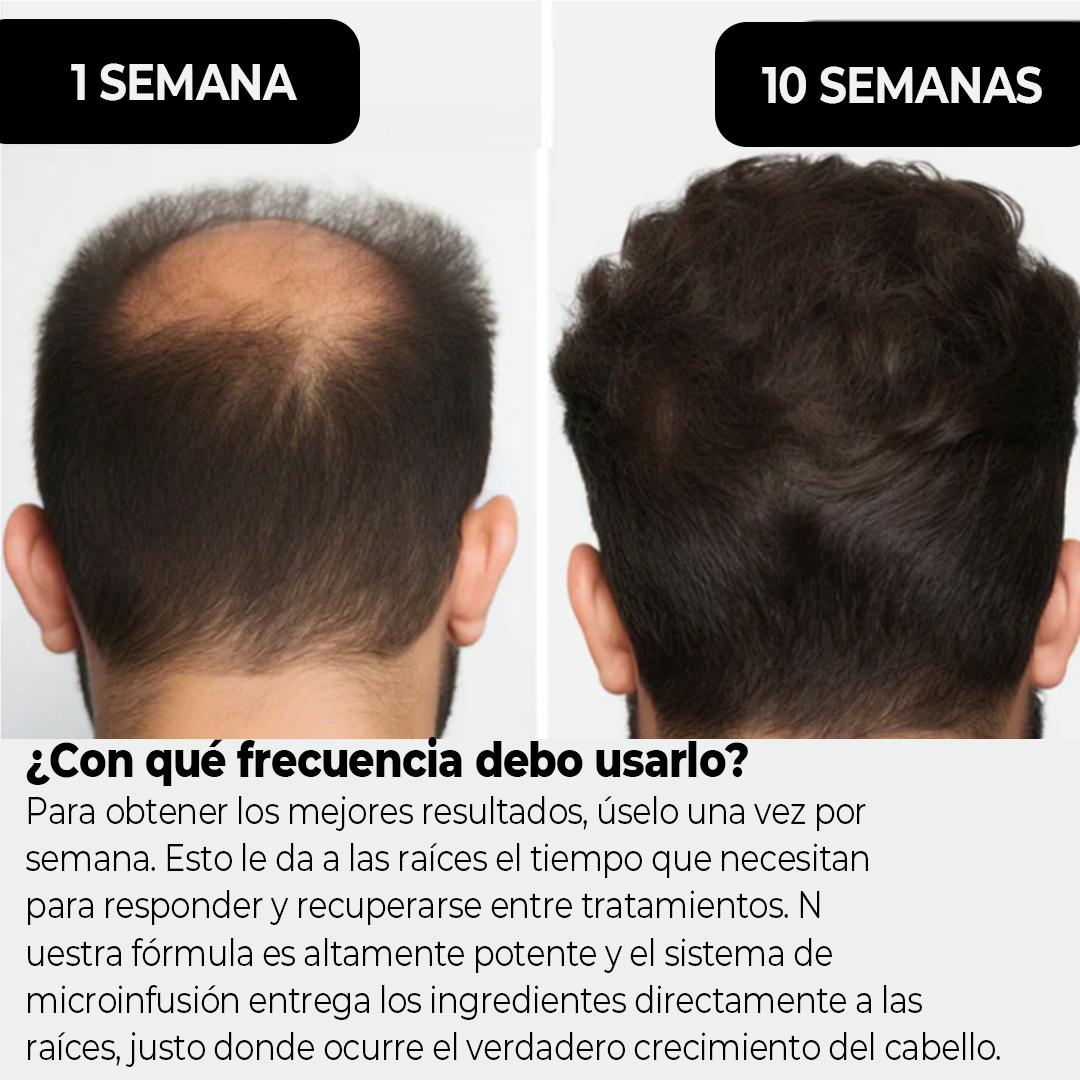 MascoLuciel™ Early Care