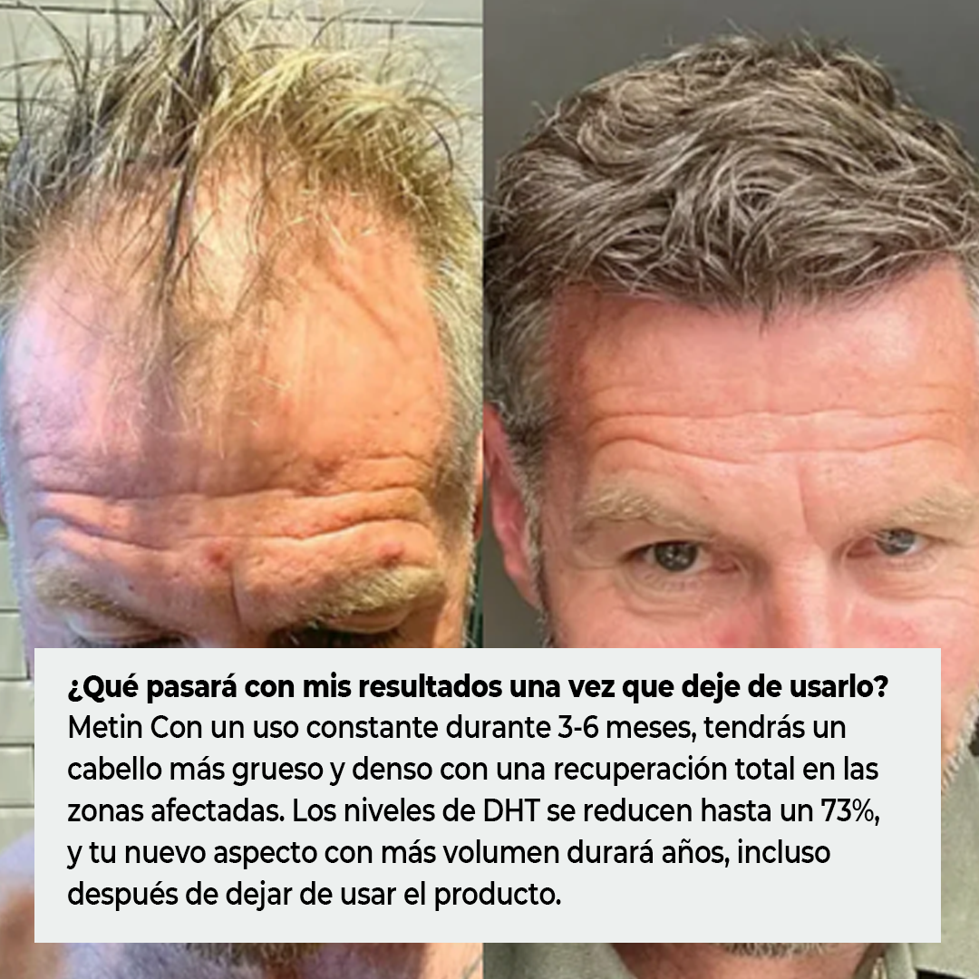 MascoLuciel™ Early Care