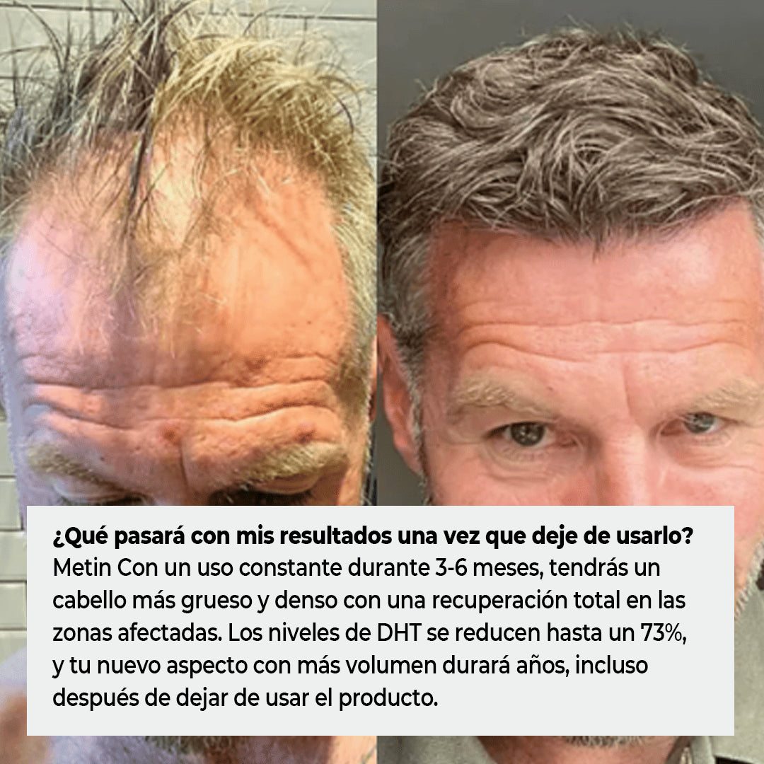 MascoLuciel™ Cuidado Capilar Temprano